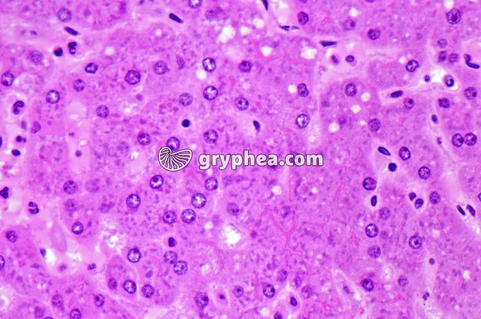 Foie humain x170 - gryphea.org